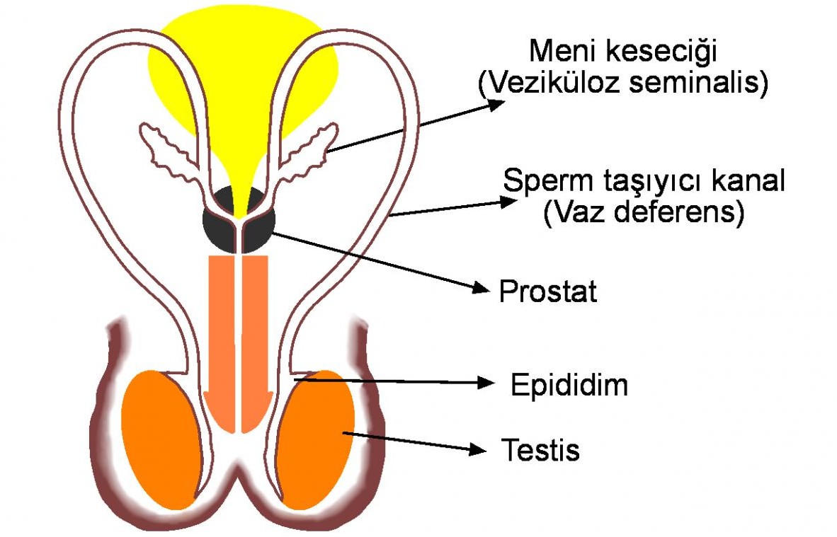 Sperm Oluşmaması Ve Mikro TESE Yöntemi (Video)